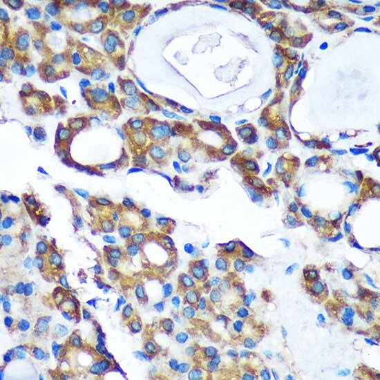 PDXDC1 Antibody