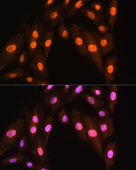 BRMS1 Antibody