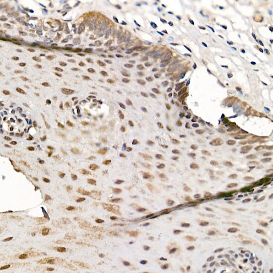 CrkRS Antibody