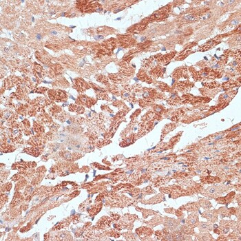 TXNDC Antibody