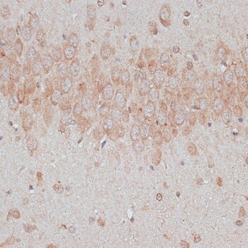 TXNDC Antibody