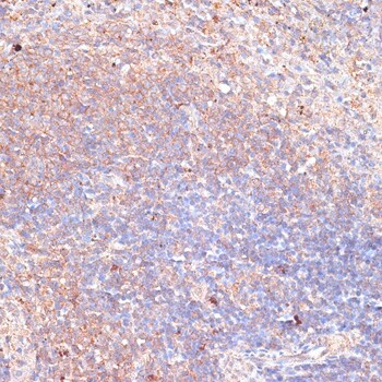 TXNDC Antibody