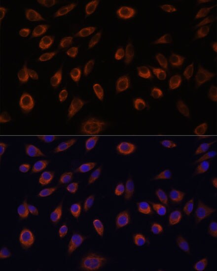 NTPCR Antibody