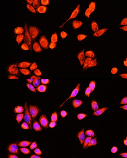 DNAJC19 Antibody