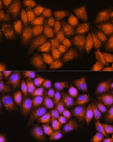 Coatomer Subunit Delta Antibody