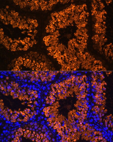 Lactate Dehydrogenase C Antibody