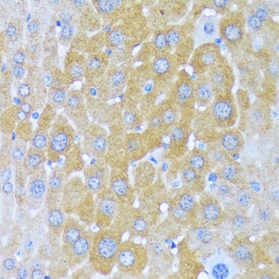 Alanyl tRNA synthetase Antibody