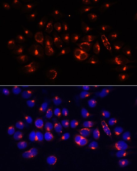 Alanyl tRNA synthetase Antibody