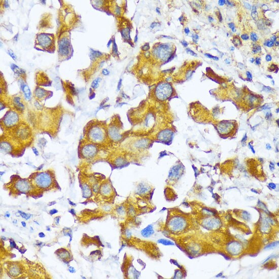 Alanyl tRNA synthetase Antibody