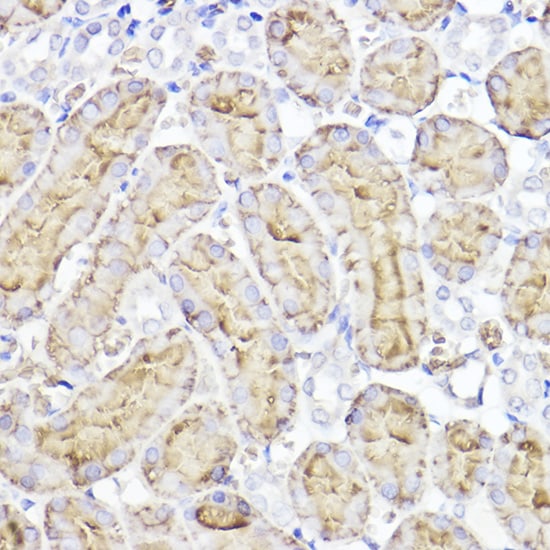 Aquaporin 1/AQP1 Antibody