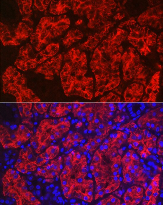 Aquaporin 1/AQP1 Antibody
