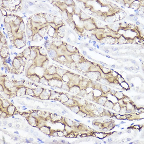 Aquaporin 1/AQP1 Antibody
