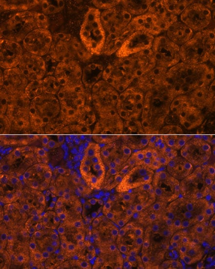 epithelial Sodium Channel gamma Antibody