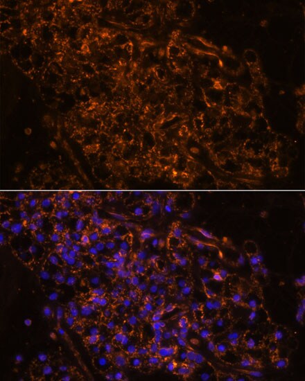 epithelial Sodium Channel gamma Antibody