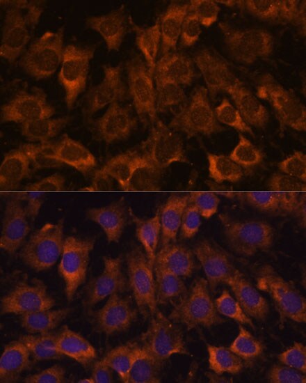 SEC23B Antibody
