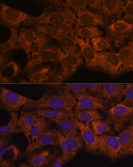 SEC23B Antibody