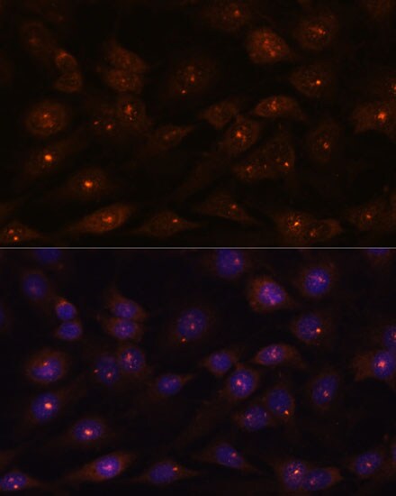 RNASEH2A Antibody