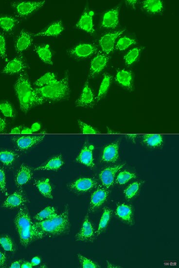 MCCC2 Antibody