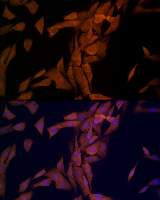 OTUD4 Antibody