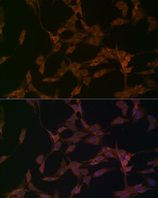 OTUD4 Antibody
