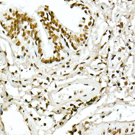 H4 Clustered Histone 1 [ac Lys5] Antibody