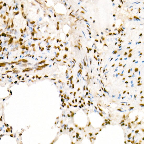 H4 Clustered Histone 1 [ac Lys5] Antibody