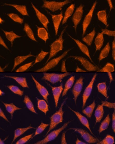 FLJ21908 Antibody