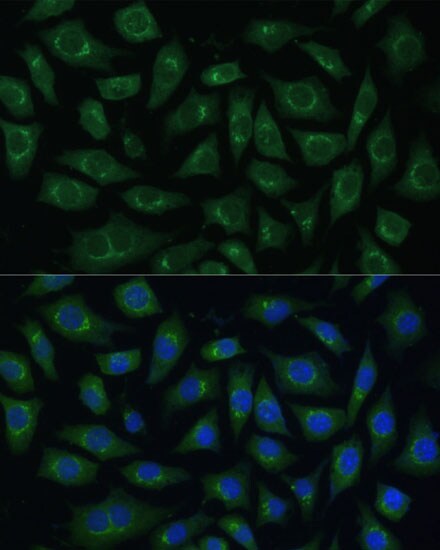 ARL1 Antibody