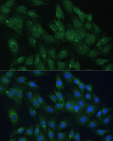 ARL1 Antibody