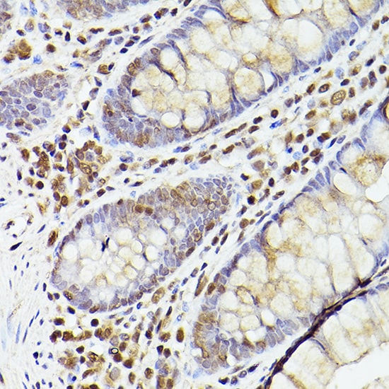 TET2 Antibody