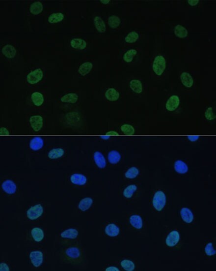 TFIIE-alpha Antibody