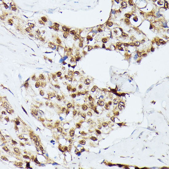 KIF22 Antibody