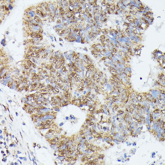 KIF22 Antibody