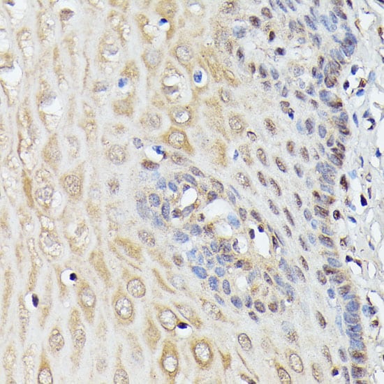 ASC1 Antibody