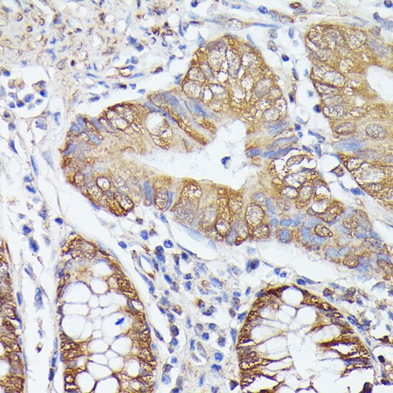 ASC1 Antibody