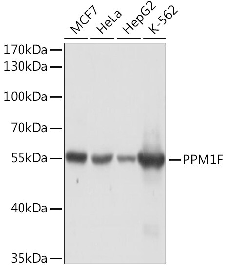 Protein phosphatase 1F Antibody
