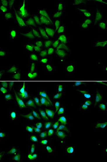 SUG1 Antibody