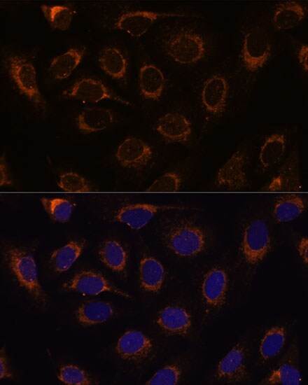 TCIRG1 Antibody