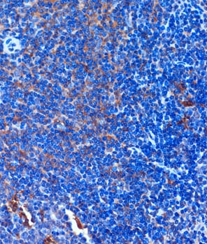 TCIRG1 Antibody