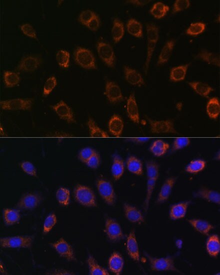 TCIRG1 Antibody