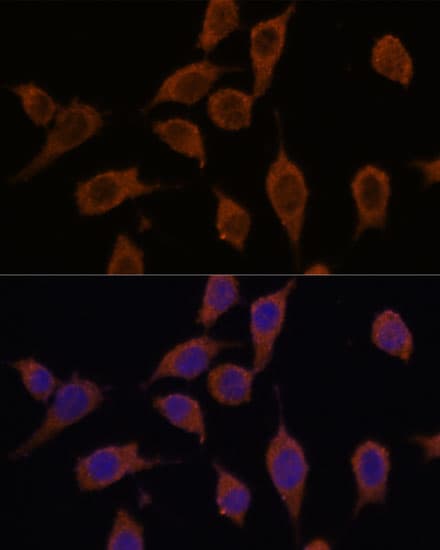 SEC23IP Antibody