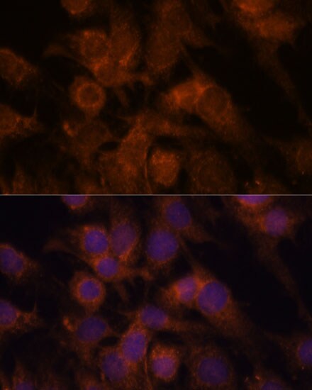 SEC23IP Antibody