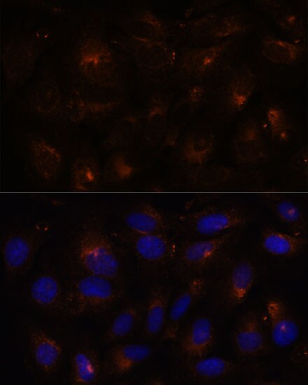 FAM62A Antibody