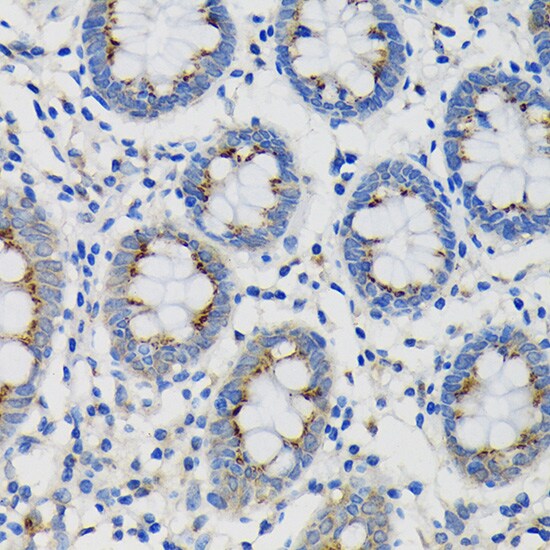SDF4 Antibody