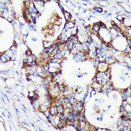 CCDC44 Antibody