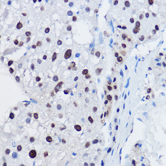 Apc11 Antibody