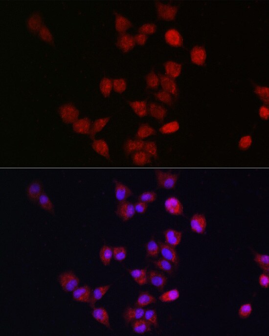Apc11 Antibody