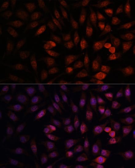 DDX24 Antibody