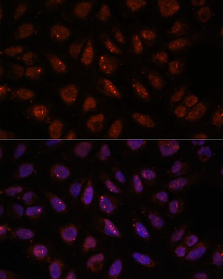 DDX24 Antibody