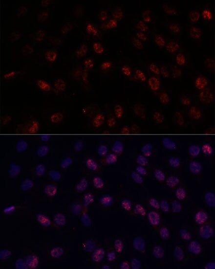 DDX24 Antibody
